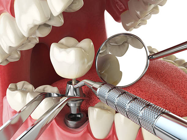 Best Urgent Tooth Repair  in Lisbon, ME